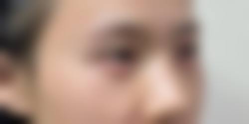 冯啸医生擅长项目