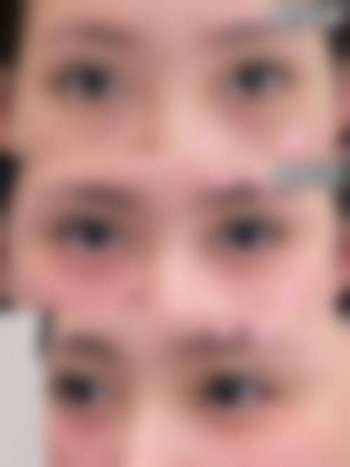 冯啸医生口碑评价及真人实例