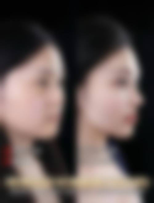 二、杭州云系医疗美容医院24小时人工服务的正规资质保护