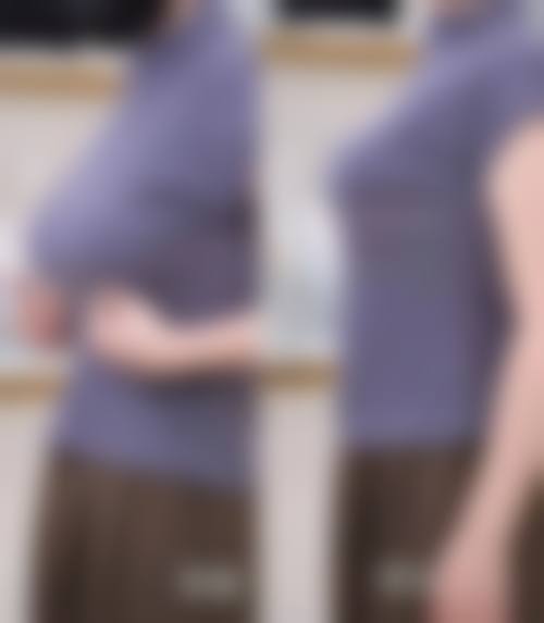 成都博漫梧桐整形擅长项目