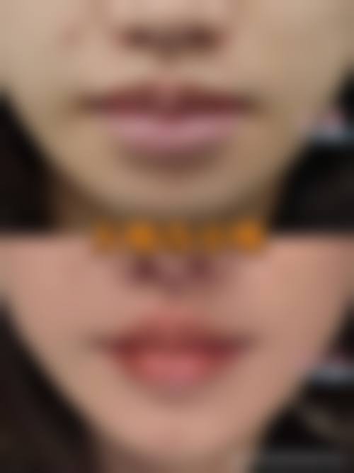 二、郑州迪美医疗美容诊所正规吗？