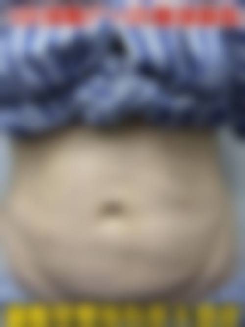 陈真林医生技术优势