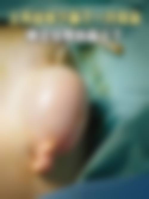 胡寅医生预约挂号