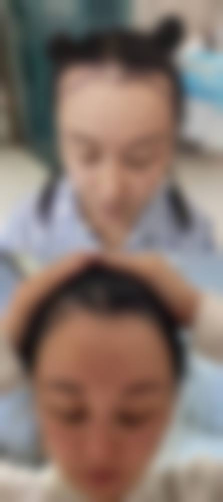 温州原辰植发医疗美容门诊部真人口碑评价怎么样？