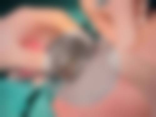 患者对李奇军技术的评价