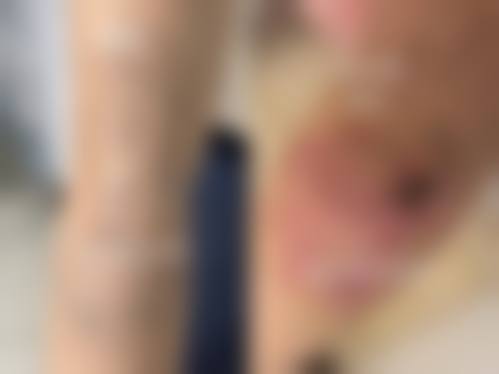 汨罗圣美整形医院特色项目及技术优势