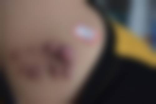 汨罗圣美整形医院详细的预约挂号方式及流程