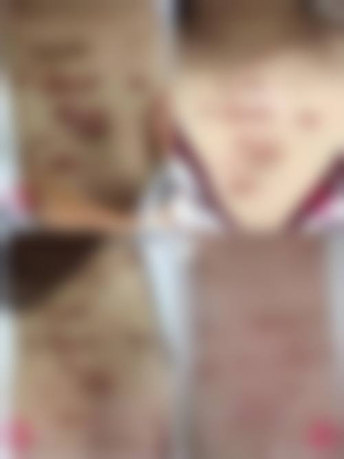 患者对杨东运医生的真实评价