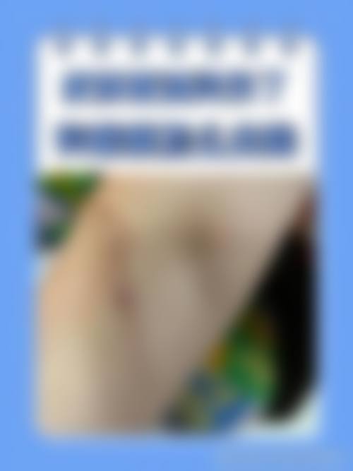 重庆杨东运怎么样？祛疤技术超精细，术后疤痕淡成浅白线，患者好评如潮