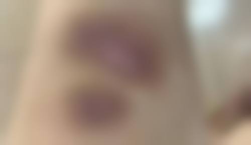 四、广州市一医院整形美容中 心五一安排解读