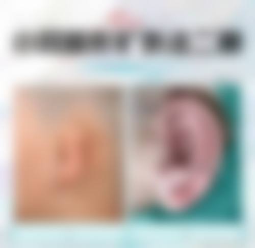 张正文Medpor生物支架耳再造