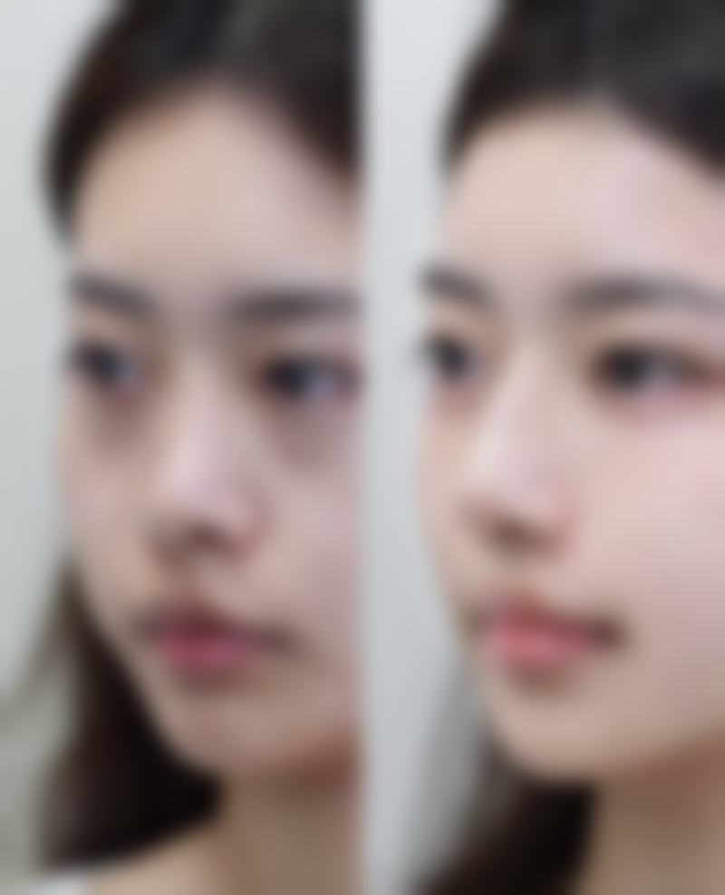 九、患者常见问题解答（精选）