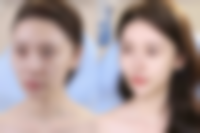 周口烧伤医疗美容医院真人口碑评价怎么样?