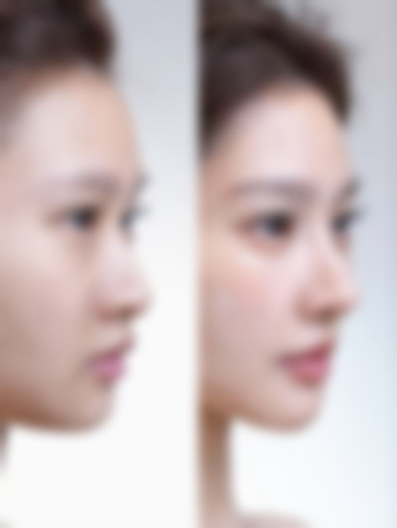 银川极至美医疗美容诊所真人口碑评价怎么样？