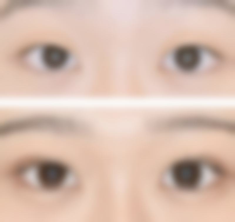 青岛刘晋胜医疗美容患者常见问题解答