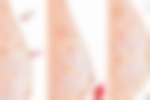 重庆市第六人民医院整形美容外科地址电话和预约挂号方式