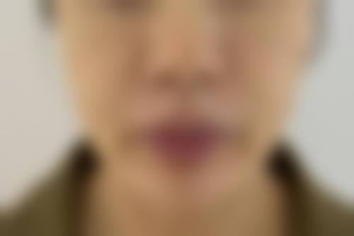 北见美容外科诊所收费价格表/收费标准