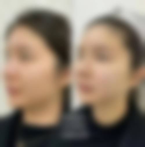 二、常州赫尔希医疗美容诊所正规吗?