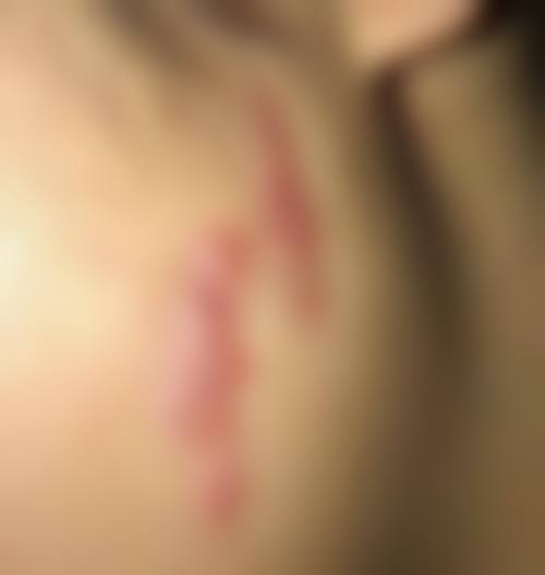 南京华肤医院价格表