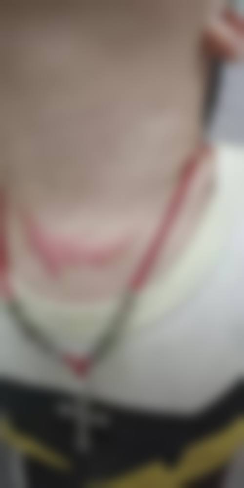 二、成都军建医院的植皮优势