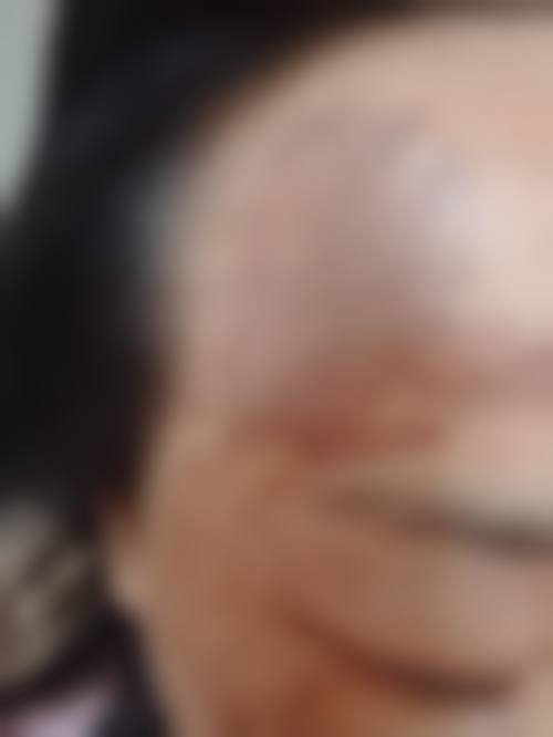 曹家整形医疗美容医院真人口碑评价怎么样？