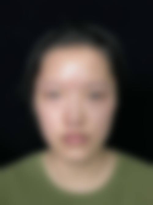 三、上海颜净整形医院的项目收费透明吗