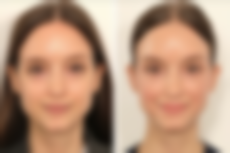 北京医梵空间医疗美容诊所口碑评价