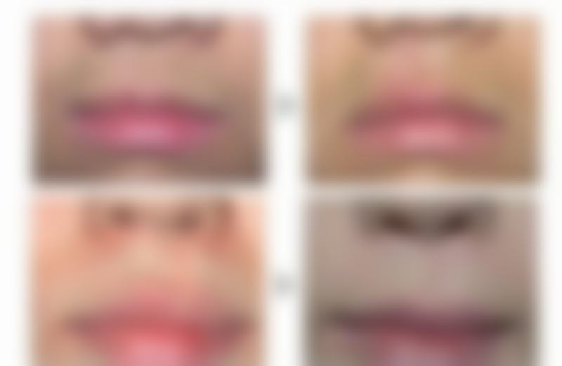 重庆军科整形vs华美整形哪个好？磨骨选华美潘宝华，鼻修复选军科林勇