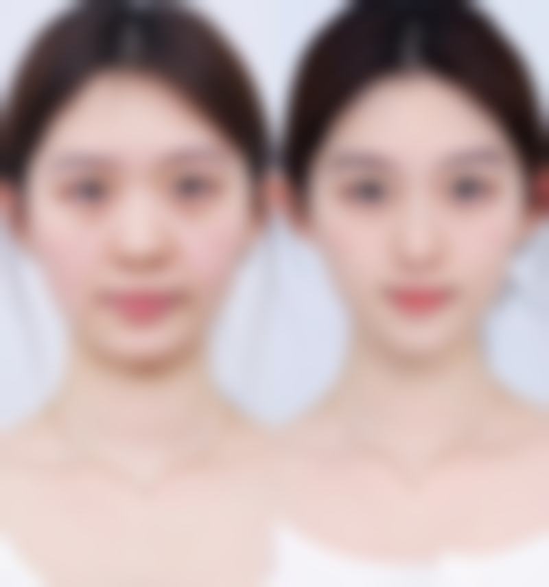 成都尺度美容医院口碑如何？