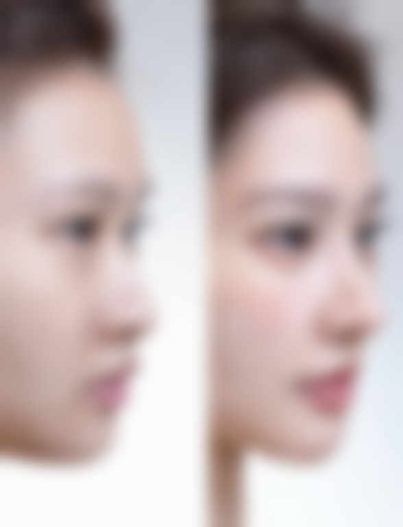 九、患者常见问题解答(精选)