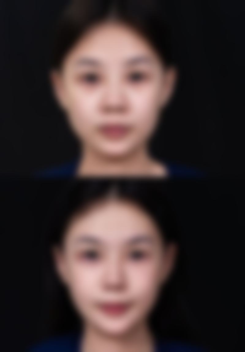 七、贵阳欣爱美医疗美容真人口碑评价怎么样？