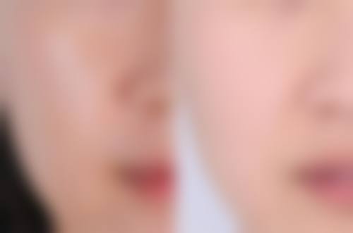 菏泽悦美医疗美容诊所详细的预约挂号方式及流程