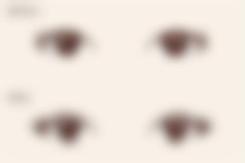 龙艳主刀贵州康视眼科斜视矫正术，2250元起，个性化方案改善外观与视力