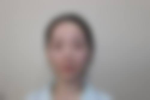 王利民医生技术优势