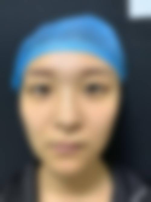 贾茉医生口碑评价及真人实例