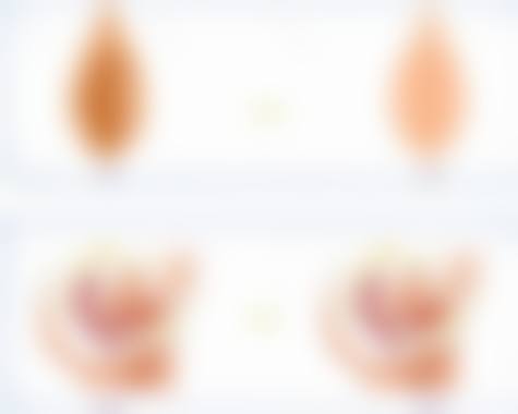 阴道紧缩针预约注意事项