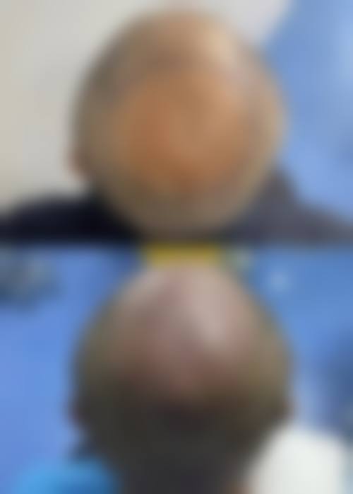 黄晓帝医生价格表