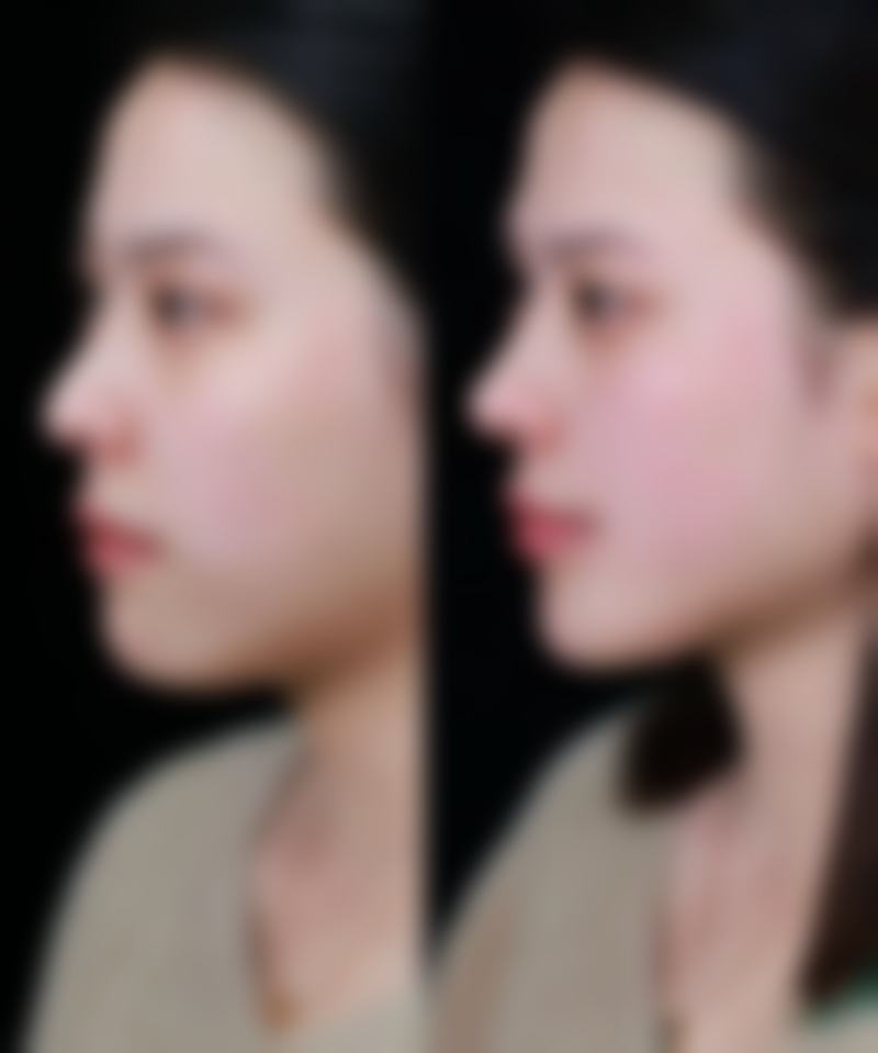 乌鲁木齐美呈医疗美容门诊部地址电话和预约挂号方式