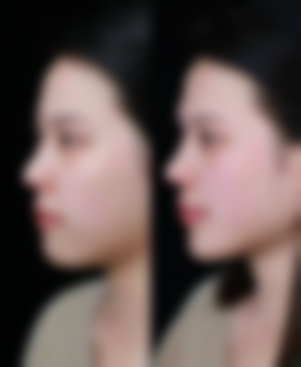 三、医生要有丰富经验