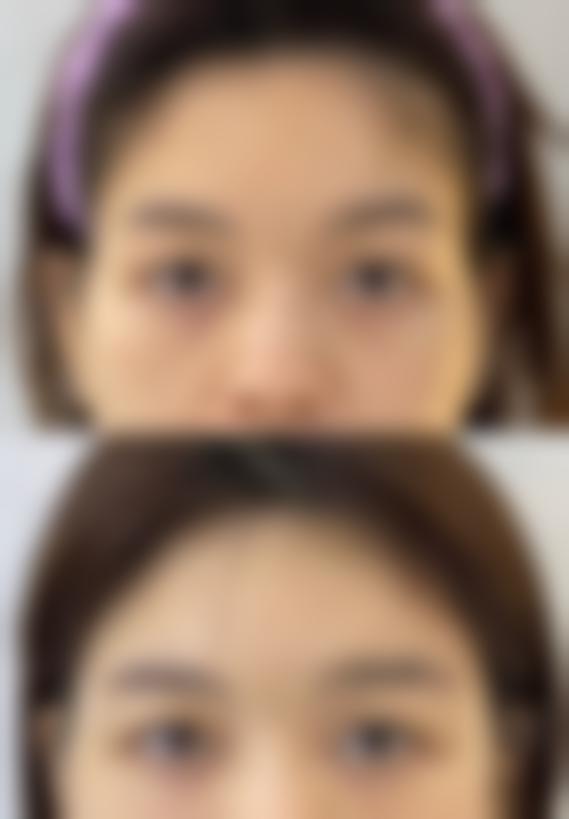 内蒙古呼伦贝尔希雅整形医院价格表