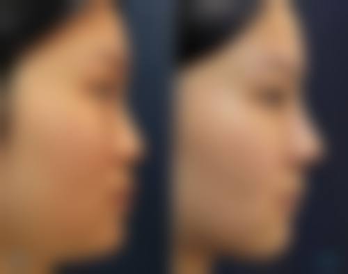 武永春医生技术优势