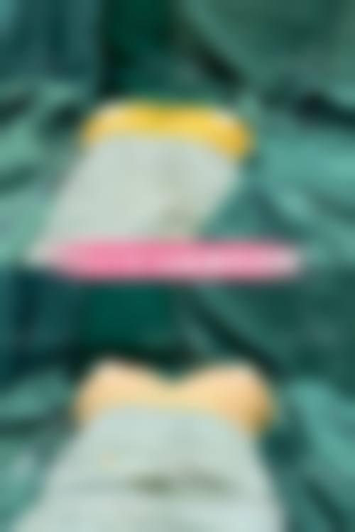 三位医生对比：选出适合你的隆胸骨干医生