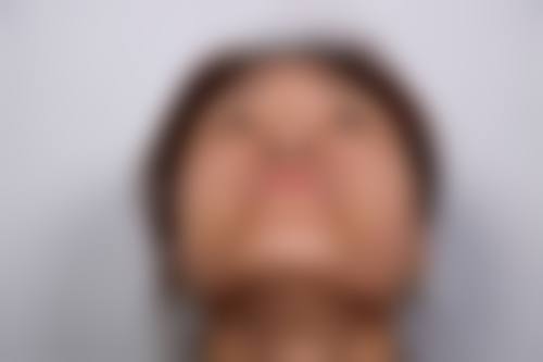 三、张沙沙医生的眼鼻技术优势