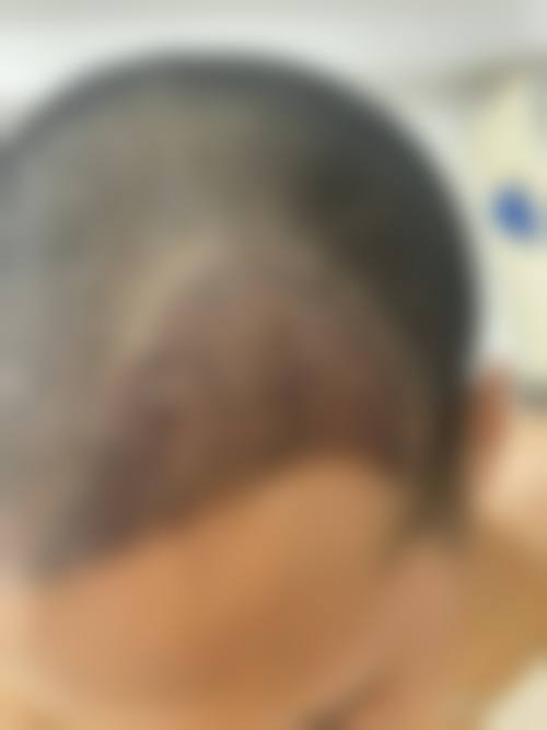 黄晓帝医生口碑评价及真人实例