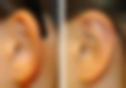 五、2026新测评上海爱丽姿耳朵整形医院的环境与服务