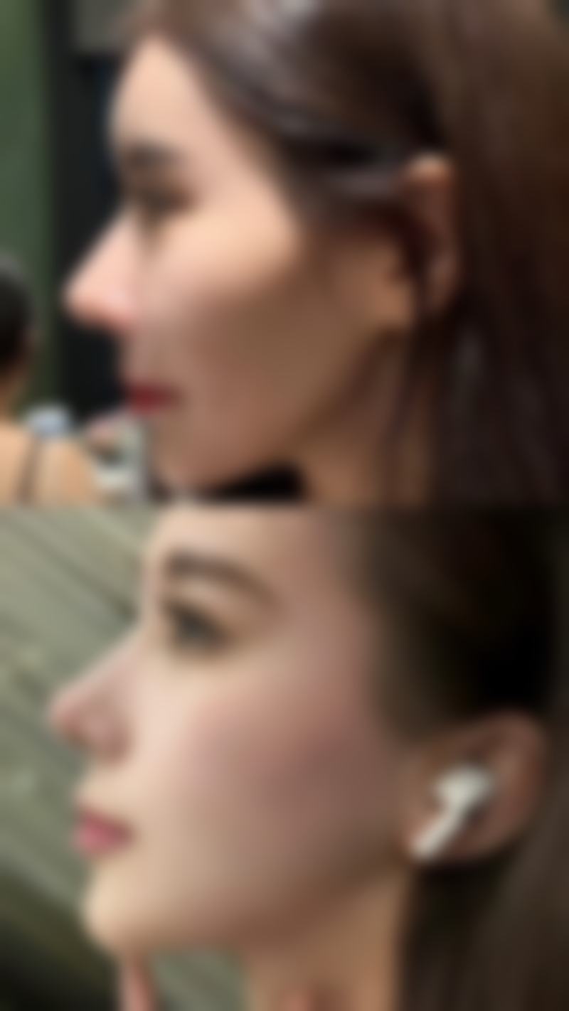 李承烈医生技术优势