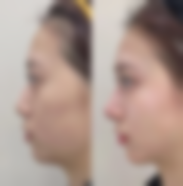 郑州乐医肤格医疗美容诊所口碑如何？