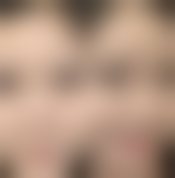 樊俊医生口碑评价及真人实例