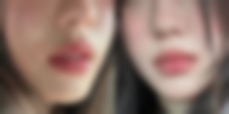 重庆整形美容三等甲医院排名公布 - 重庆大坪医院