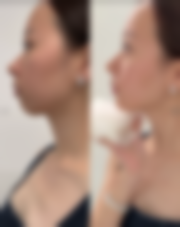 上海明珠整形外科医院特色技术及优质服务